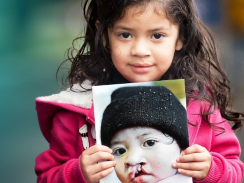 Operation Smile Case Study